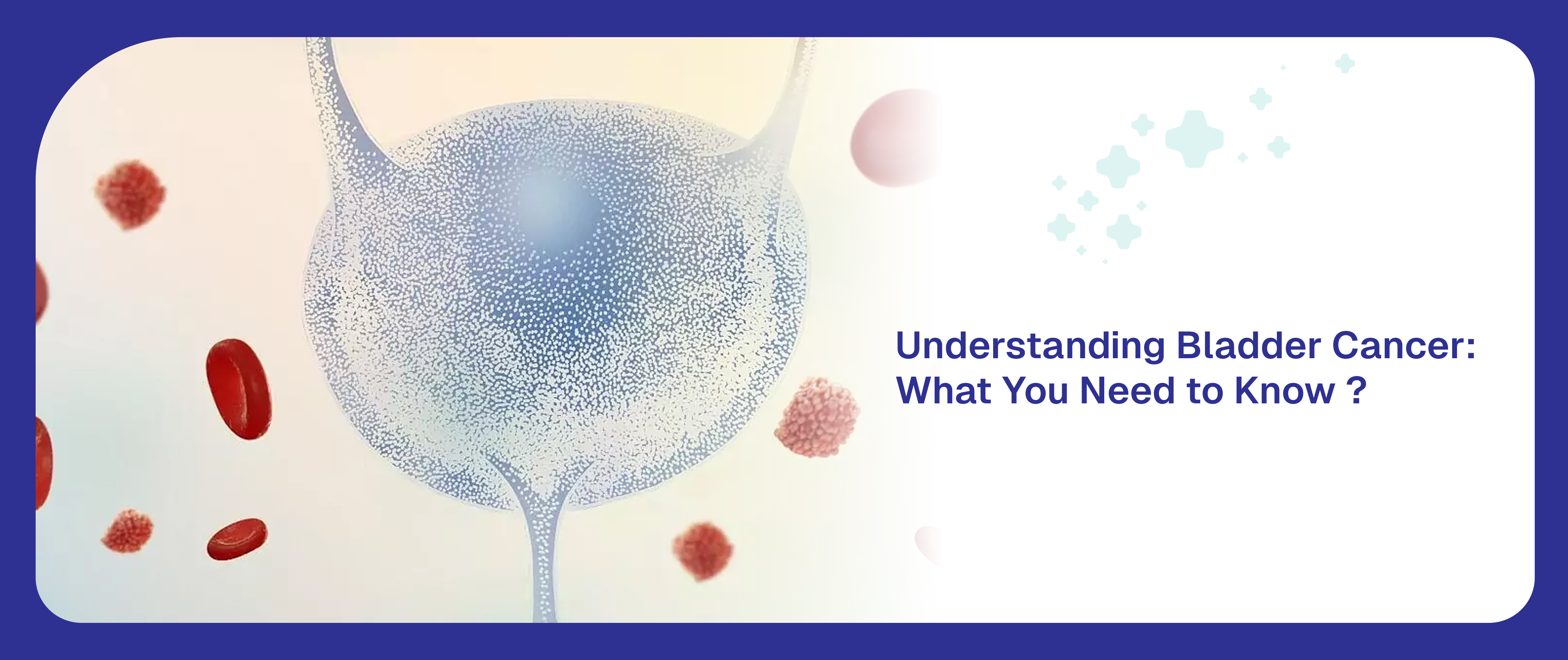 Understanding Bladder Cancer: What You Need to Know